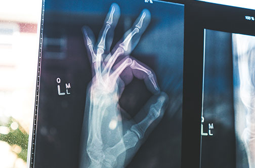 Osteoporosis Awareness
